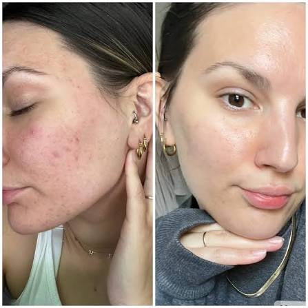 Melagenix Brightening Toner Pads